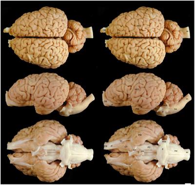 The Brain of the Black (Diceros bicornis) and White (Ceratotherium simum) African Rhinoceroses: Morphology and Volumetrics from Magnetic Resonance Imaging